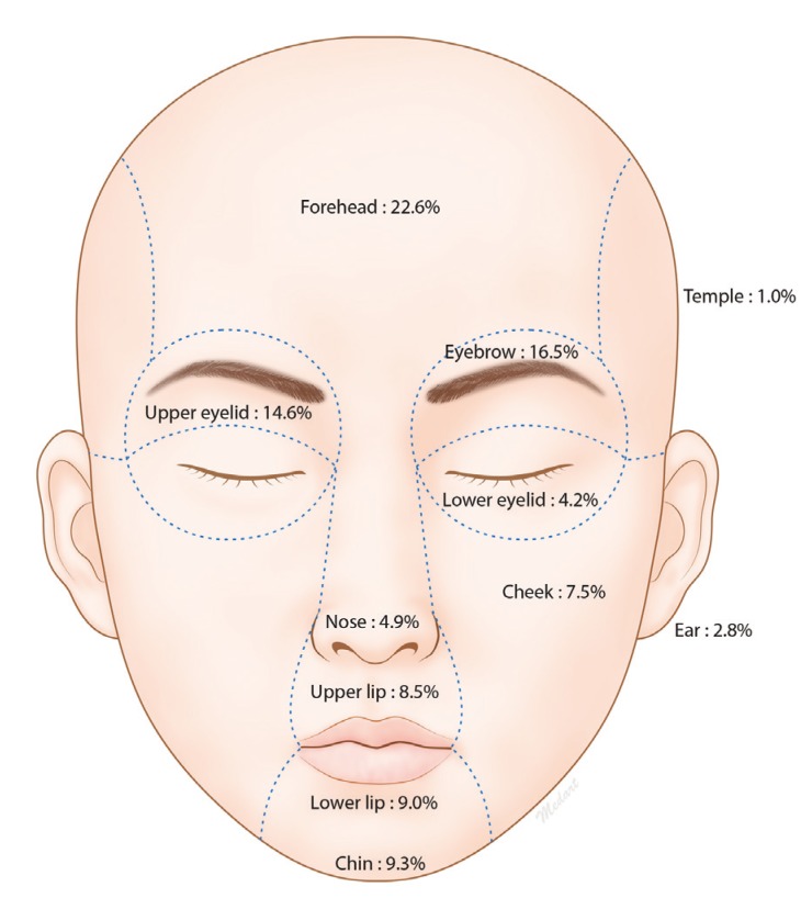 facial laceration